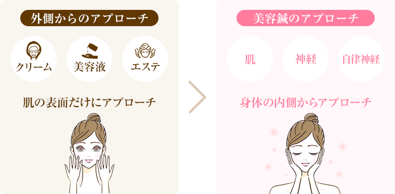 美容鍼のアプローチ画像